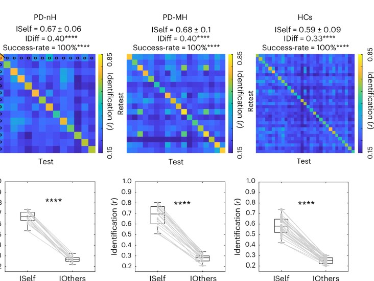 Figure: patient-specific functional networks in Parkinson's disease